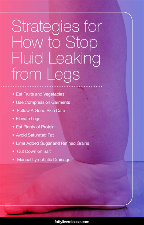 Leaky legs: strategies for the treatment and。